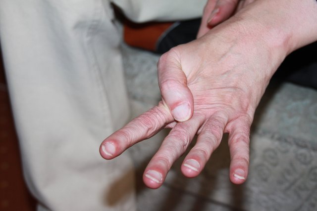 Thomas Klemps Finger sind extrem flexibel