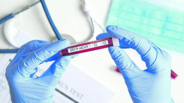 Häufiges Testen gehört zur Strategie im Kampf gegen Corona