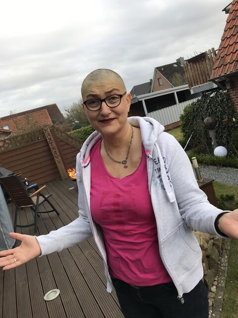 Ohne Haare | Foto: Hartmann