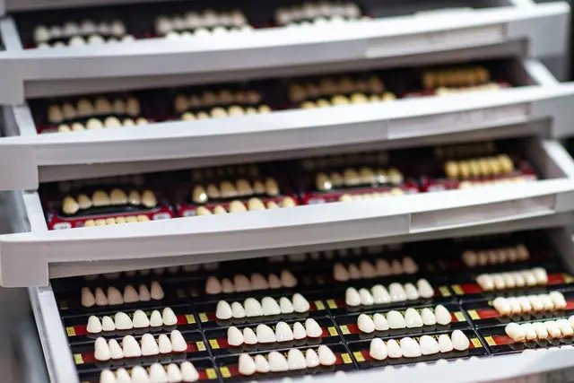 Moderne Zahnästhetik bei Cosmedica Dental - Veneers in der Türkei | Foto: Cosmedica Dental