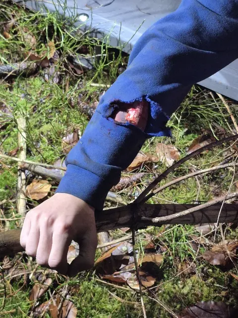 Wie im echten Leben: Die "vermisste Person" hatte einen geschminkten und nachmodellierten "offenen Bruch" | Foto: pöp