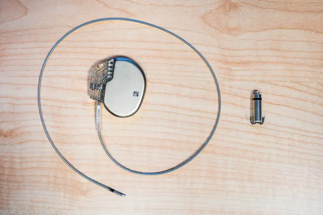 Links der konventionelle Schrittmacher mit Gehäuse und Sonde, rechts der Leadless Pacemaker in Form einer einzelnen Kapsel | Foto: Elbe Kliniken/Sebastian Braeutigam