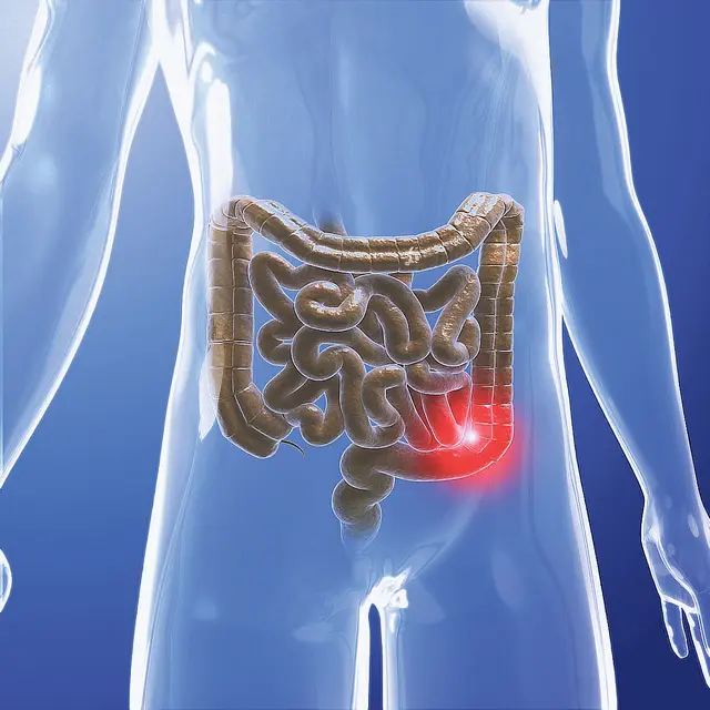 Darmkrebs ist bei Früherkennung gut heilbar | Foto: Bayer HealthCare