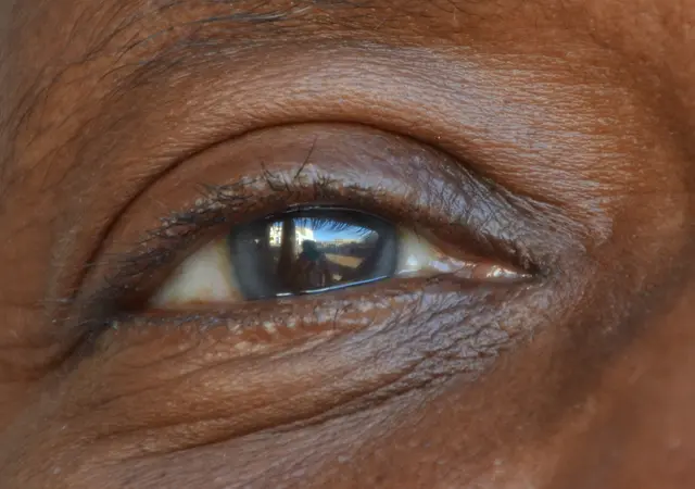 Manchmal sind es Details wie ein Auge, die viel erzählen | Foto: Hermann Isenberg